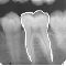Dental, bitemarks