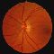 Retinal