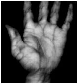 Palm veins